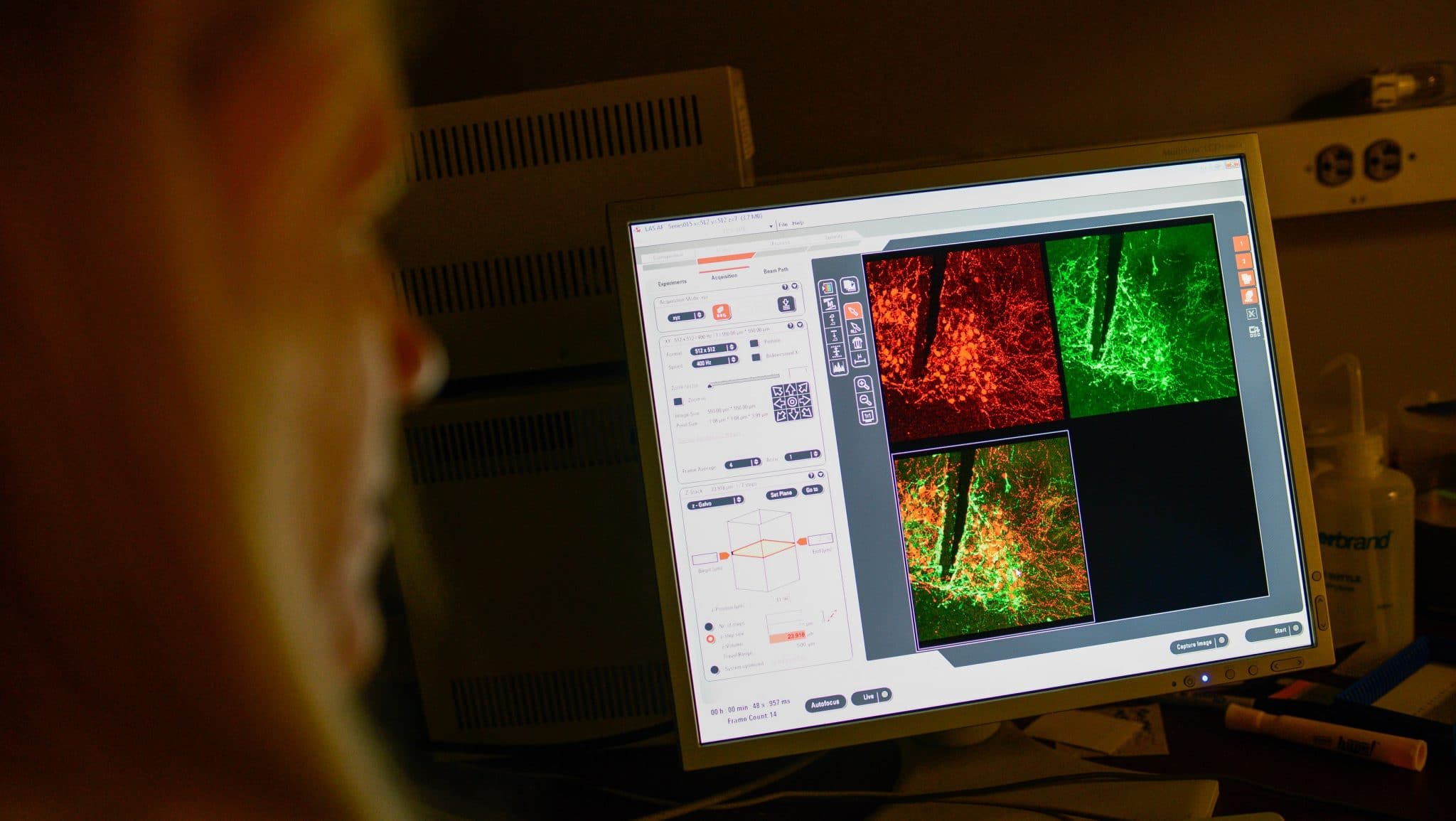 Heather Patisaul studies how chemicals in the environment affect us. In this image, she’s examining neurons in the brain of a laboratory rat colored by a process called immunohistochemistry.