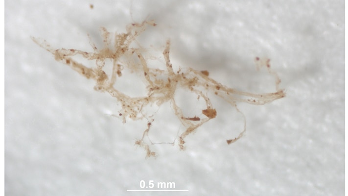 Blood vessels from deminineralized bone of B. canadensis